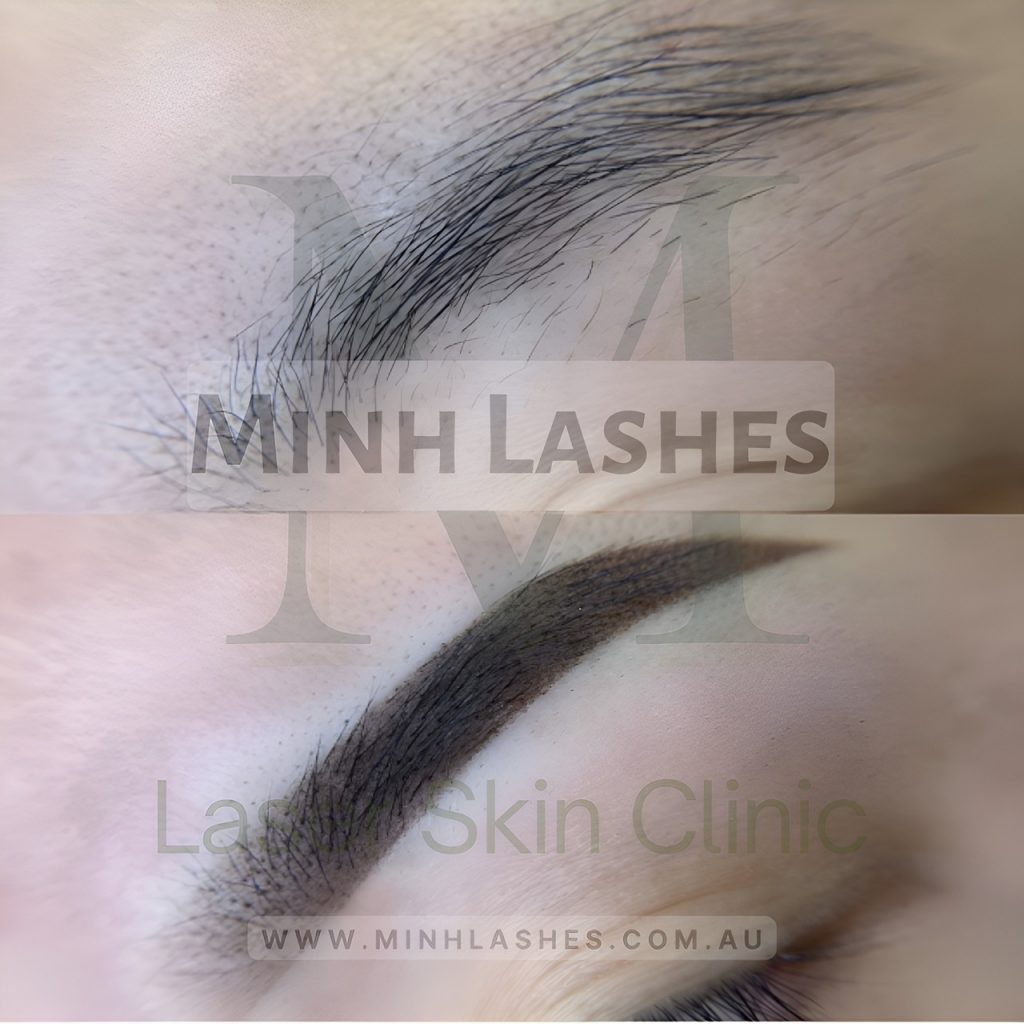 Minh Lashes - Eyelash Extensions - Laser Skin Clinic - For Men & Women - Beauty Supplies