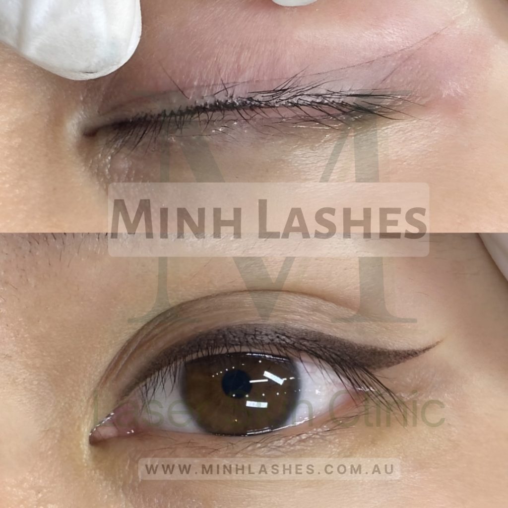 Minh Lashes - Eyeliner Tattoo