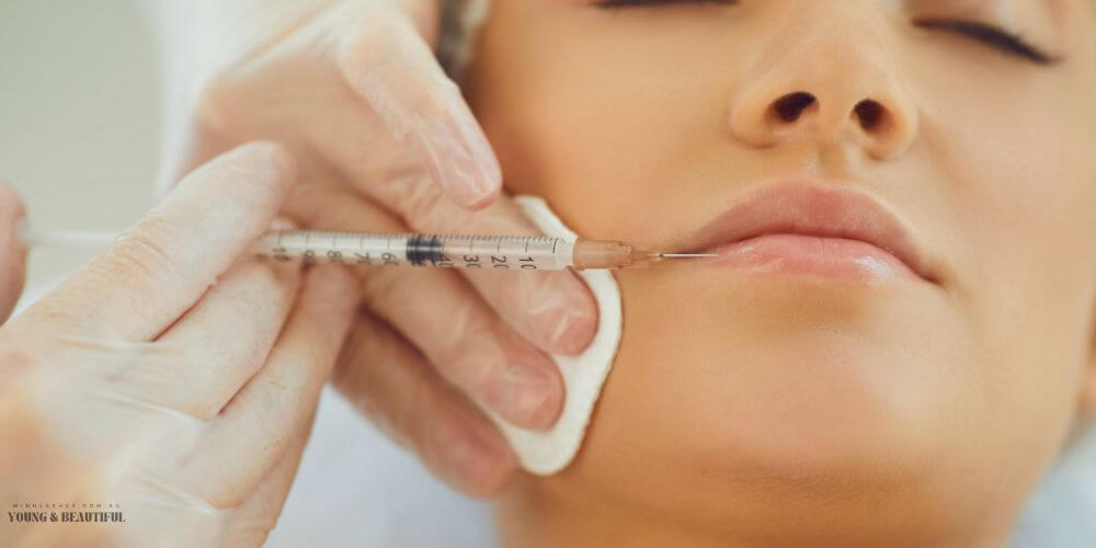 Woman receiving do lip fillers hurt injection at Minh Lashes Beauty Clinic in Sydney — safe, gentle, and professional treatment for natural enhancement.