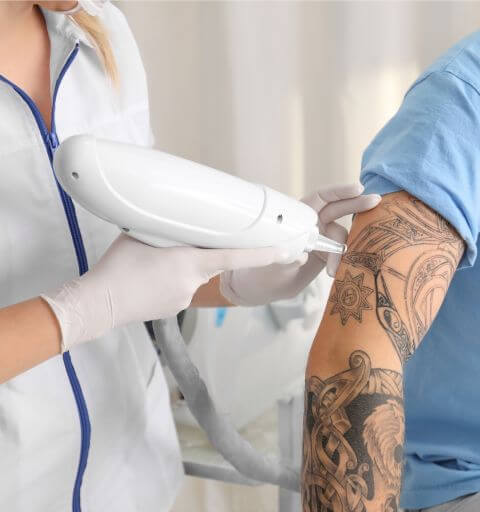 Laser tattoo removal treatment in progress at Minh Lashes Beauty Clinic Bankstown