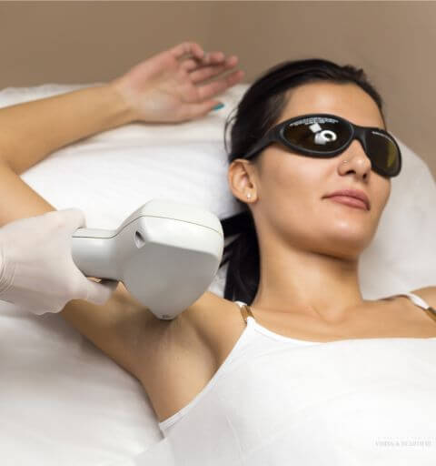 Woman receiving laser hair removal treatment at Minh Lashes Beauty Clinic in Bankstown